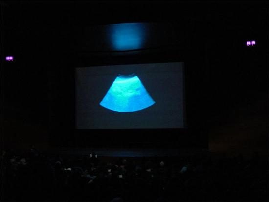 Kubo txiki pantalla 16